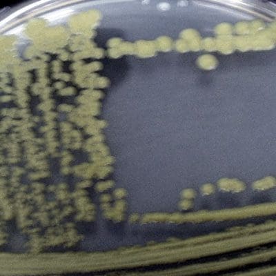 Micrococcus luteus