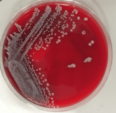 Campylobacter jejuni | Microchem Laboratory