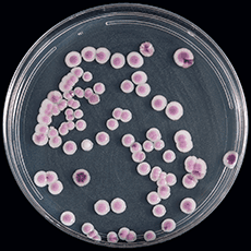 Candida Parapsilosis Pseudohyphae Candida Parapsilosis Pseudohyphae