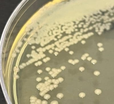 Pseudomonas Fluorescens Microchem Laboratory