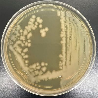 Salmonella typhii | Microchem Laboratory