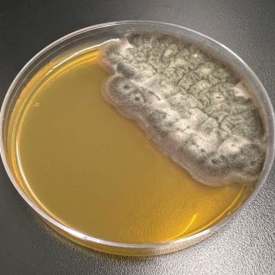 Stachybotrys chartarum | Microchem Laboratory