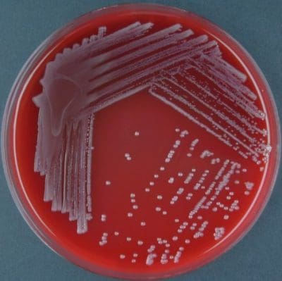 Bordetella Bronchiseptica | Microchem Laboratory