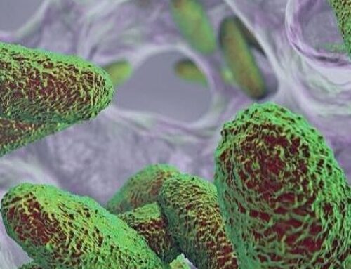 Remarkable Number of Infections Are Associated With Biofilms