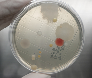 Science behind ID of unknown bacteria and fungi