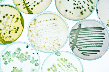 bacteria plates