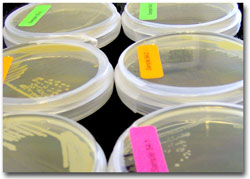 Petri dish plate counts