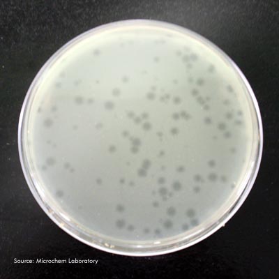 MS2 Bacteriophage Plaques